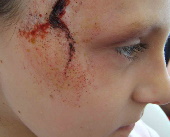fake wound
